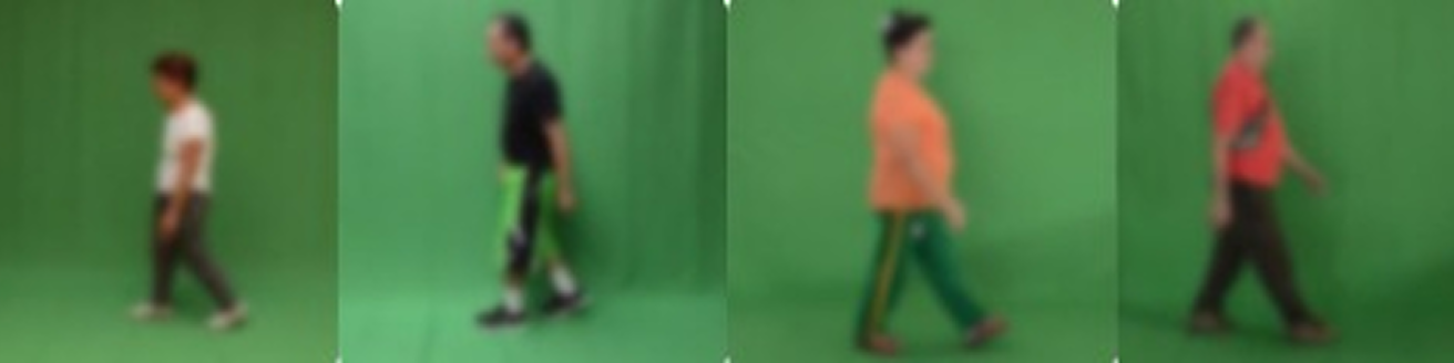 Parkinson's disease dataset